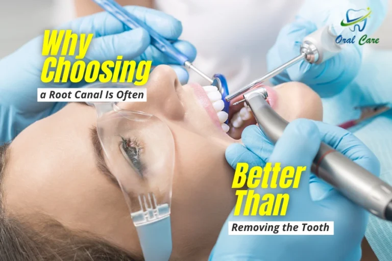 Painless RCT in Delhi